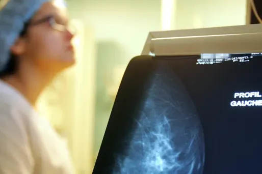 cancer du sein mammographie 1280